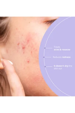 Freshly Cosmetics Azelaic Radiance^Mujer Cosmética