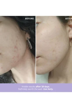 Freshly Cosmetics Azelaic Radiance^Mujer Cosmética